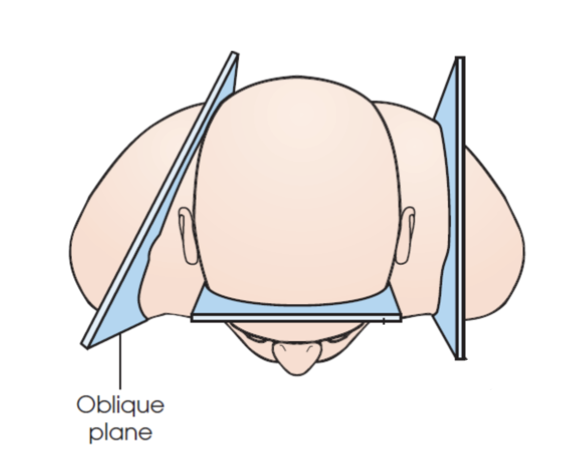 <p>what plane is this?</p>