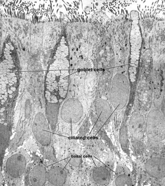 <p>What kind of cells are these that are in the trachea?</p>