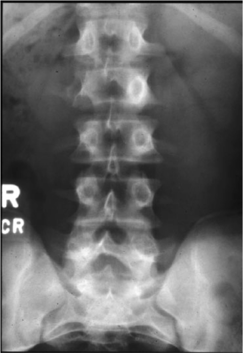 <p>What is the finding and what is the diagnosis?</p>