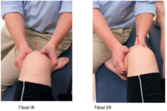 <p>Anterior drawer with foot in 30° IR (ALRI) or 15° ER (AMRI); tests rotary instability.</p>