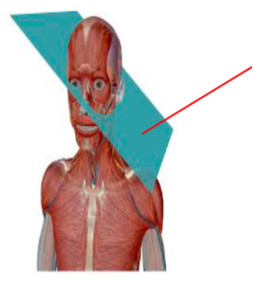 <p>Oblique plane</p>