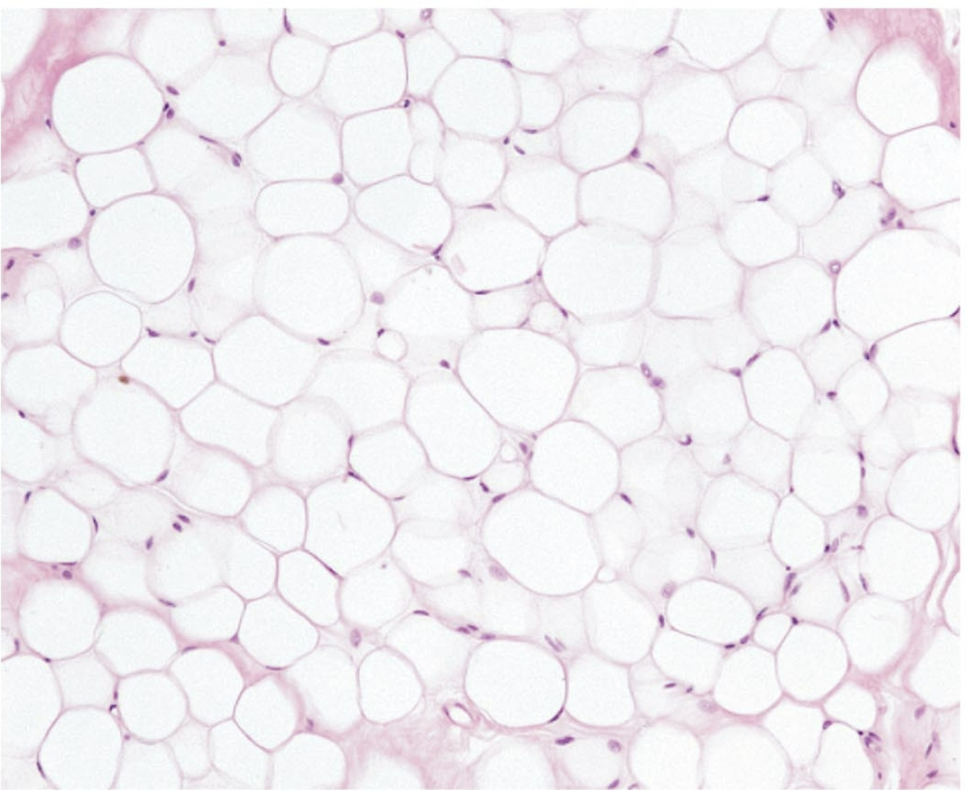 <p>what tissue is this</p>