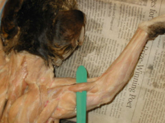 <p>muscle that works together with the biceps brachii to flex the elbow</p>