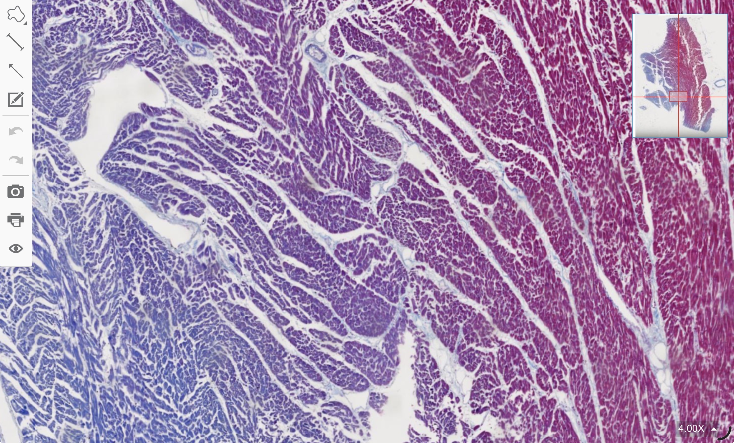 term image