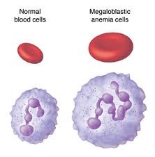 <p>Impaired production, destruction, or fluid loss of red blood cells.</p>
