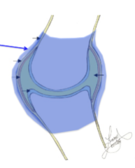<p>Thickenings of the fibrous capsule itself that take the form of either bands or triangles</p>