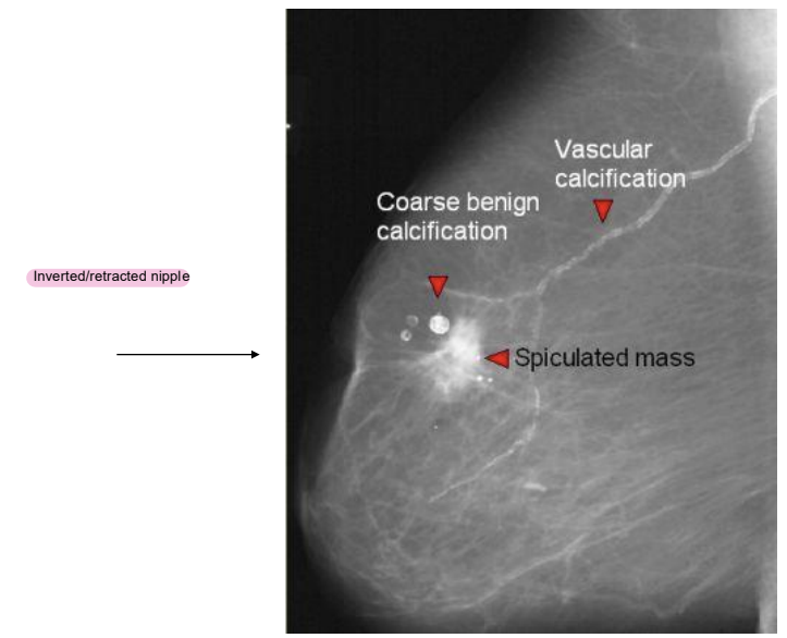 <p>What kind of mass is this</p>