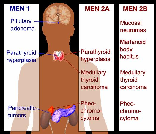 <p>MEN2a & MEN2b </p>
