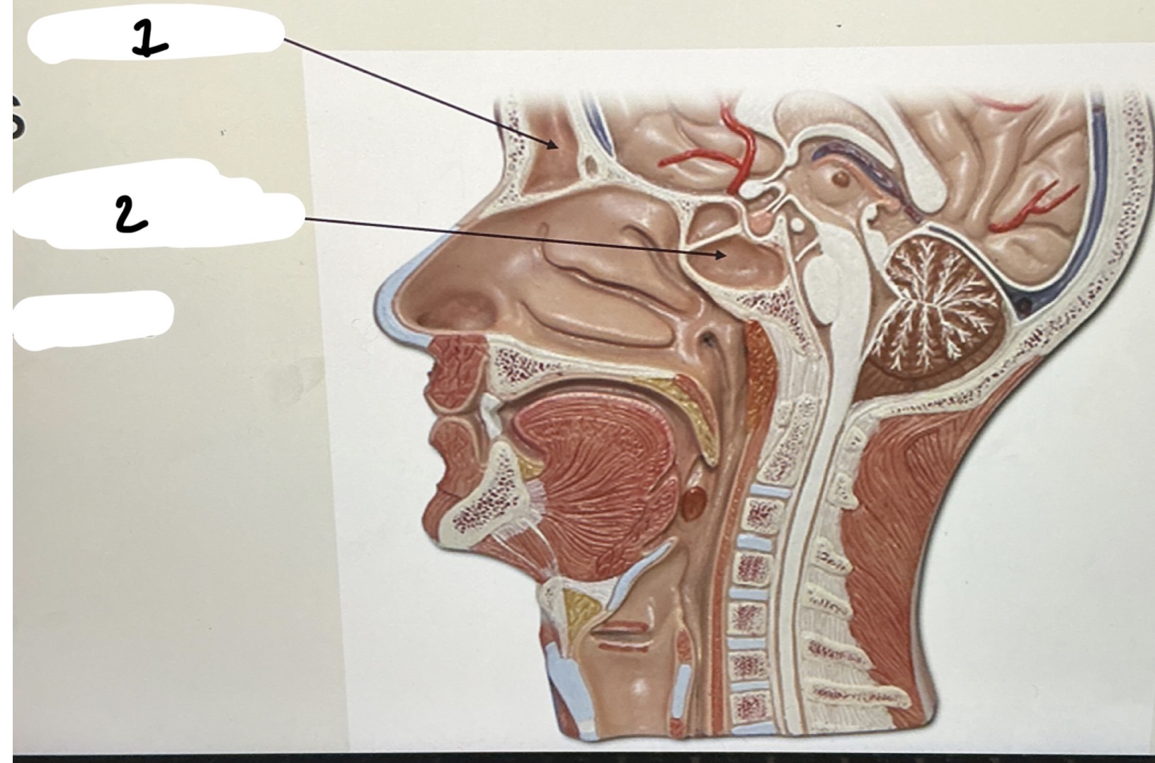 <p>Sinuses</p><p>■ Production of XX</p><p>1.XX</p><p>2.XX</p>