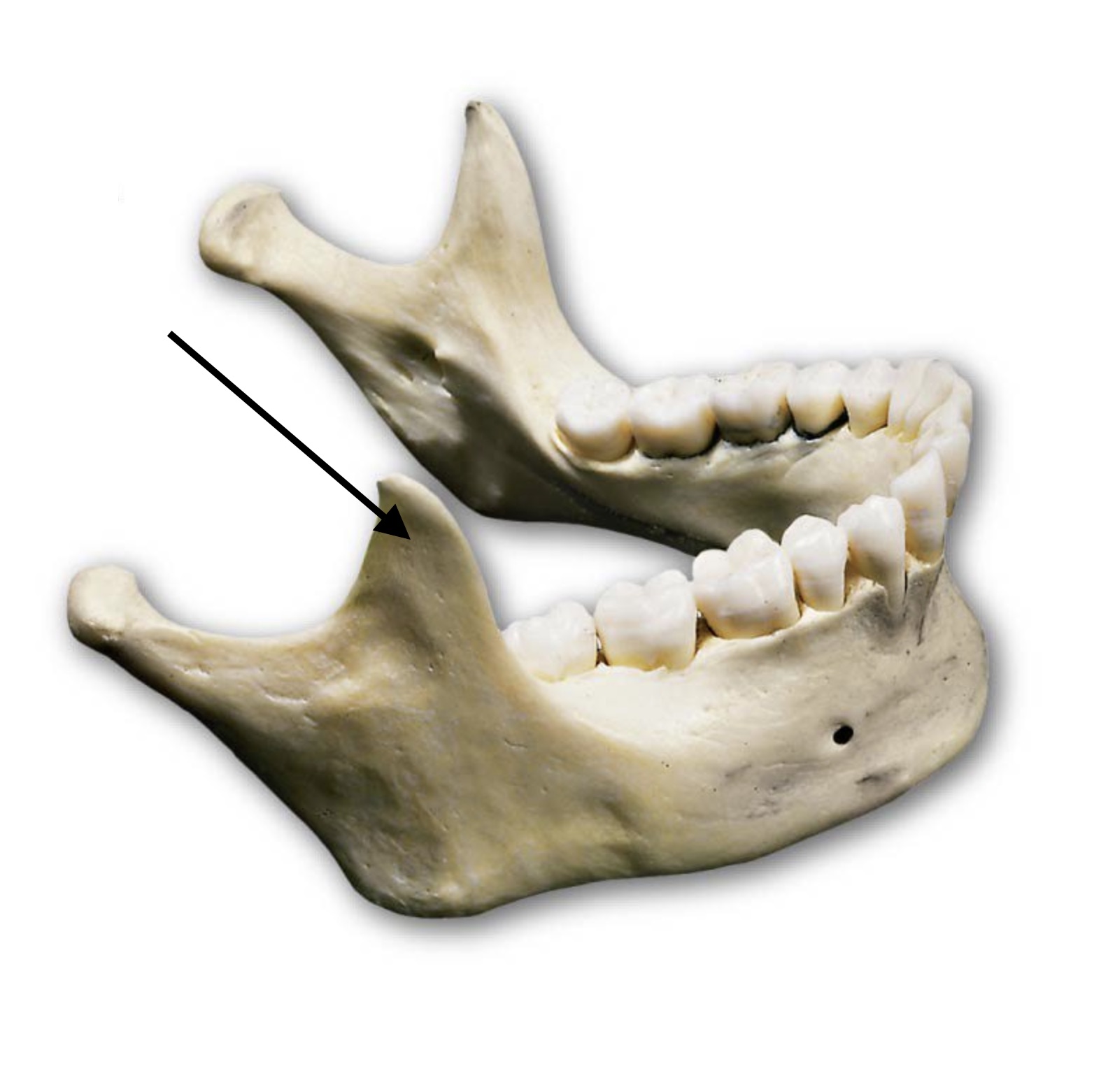 <p>An anterior superior projection of the ramus. Clue: anterior bump of the two upper jaw projections; resembles a hook.</p>