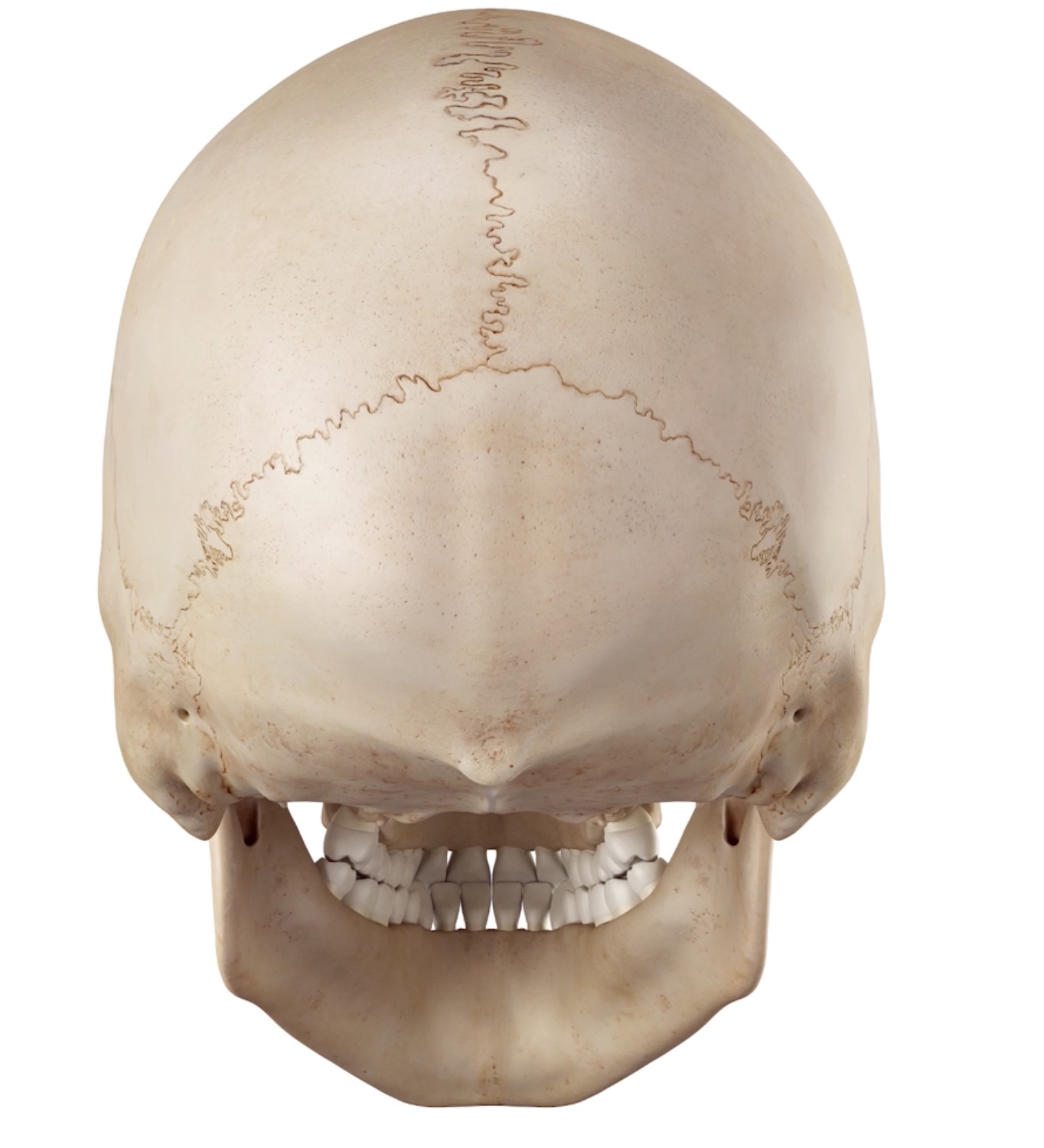 <p>What type of joint is this?</p>