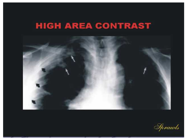 <p>Image with high contrast is not desirable.</p>