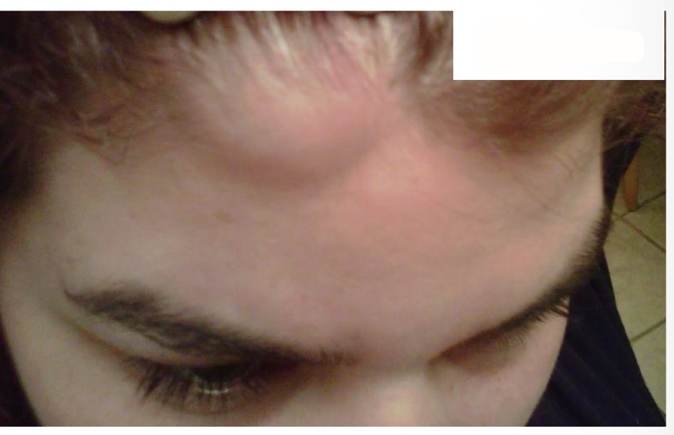 term image