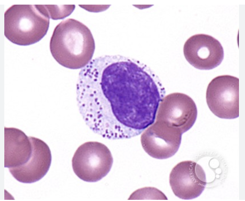 <p>spot diagnosis?</p>