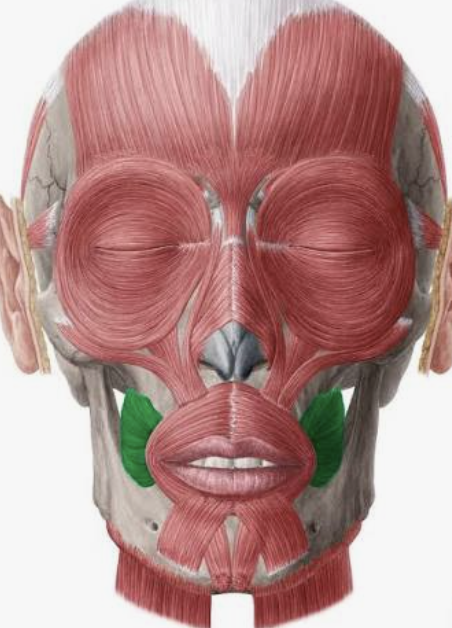 <p>Which muscle is this?</p>