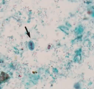 <p><span style="background-color: rgba(0, 0, 0, 0); line-height: 19.7625px;">What is the species in this photo and WHY?</span></p>