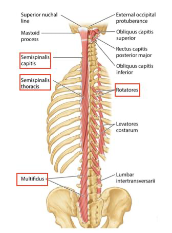 <p><span><strong>Located </strong>deep to the erector spinae muscles.</span></p><p><span>From superficial to deep: semispinalis, multifidus, and rotatores</span></p><p><span><strong>Attachment</strong></span></p><p><span>Muscle fibers arise from a transverse process and ascend between one to six vertebral levels to attach to the spinous process of neighboring vertebrae.</span></p><p><span><strong>Action</strong></span></p><p><span>Stabilization</span></p><p><span>Bilateral contraction: extension of the vertebral column</span></p><p><span>unilateral contraction: rotation of vertebral column to the contralateral side of the contracting transversospinalis muscle.</span></p><p><span><strong>Innervation</strong></span></p><p><span>Segmentally innervated by dorsal rami.</span></p><p></p><p></p>