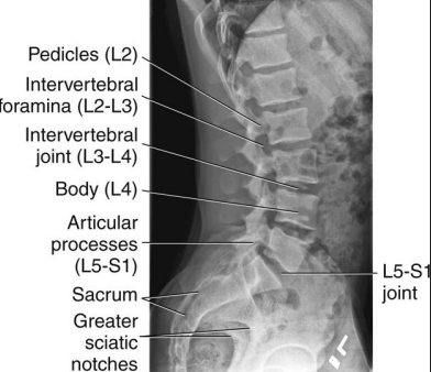 <ul><li><p>Centered at the crest to include T12 to sacrum</p></li><li><p>Spinal column aligned parallel to the IR</p></li><li><p>No tilt</p></li><li><p>No rotation</p></li></ul><p></p>