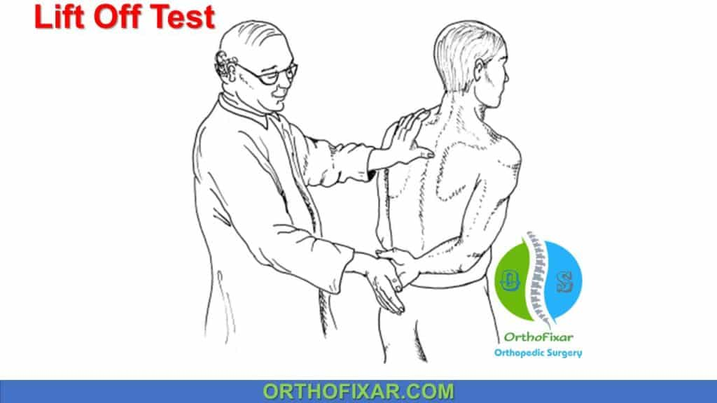 <p>Subscapularis</p>