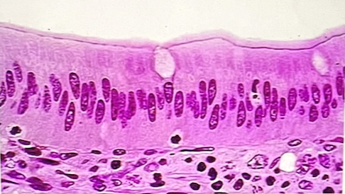 <p>which epithelial type lines the small intestine </p>