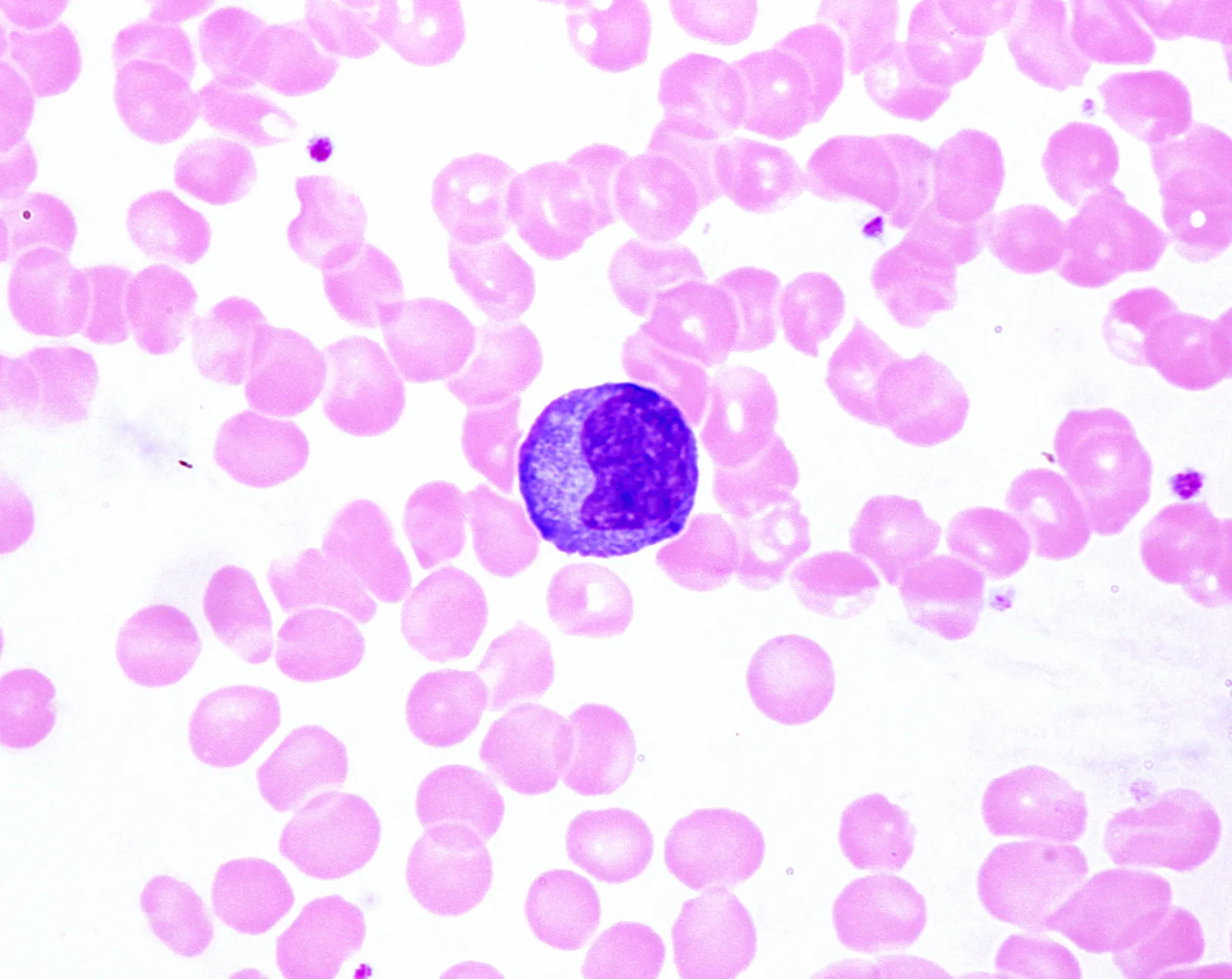 <p>Leukocytes </p>