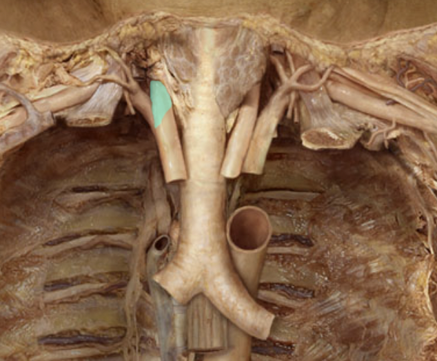 <p>Identify the feature of the arch of aorta</p>