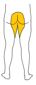 <p>Saddle sensory loss</p>