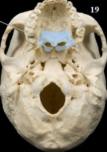 <p>What Bone is This</p>