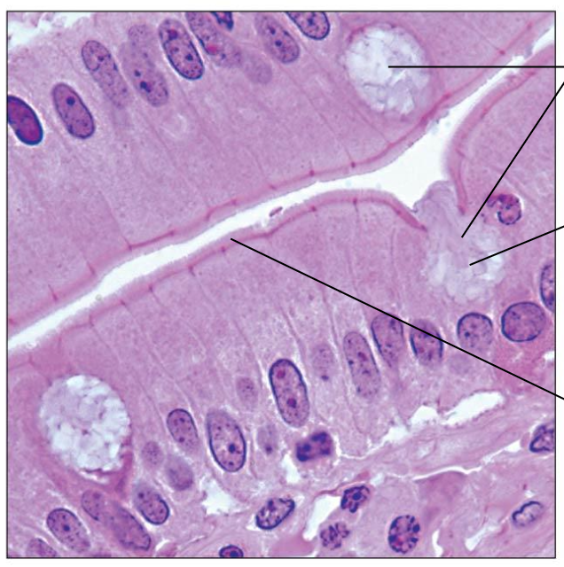 <p>Simple columnar epithelium location: </p>