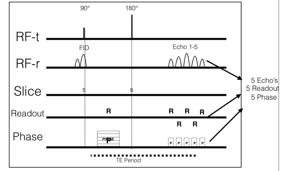 <p>EPI timing diagram</p>