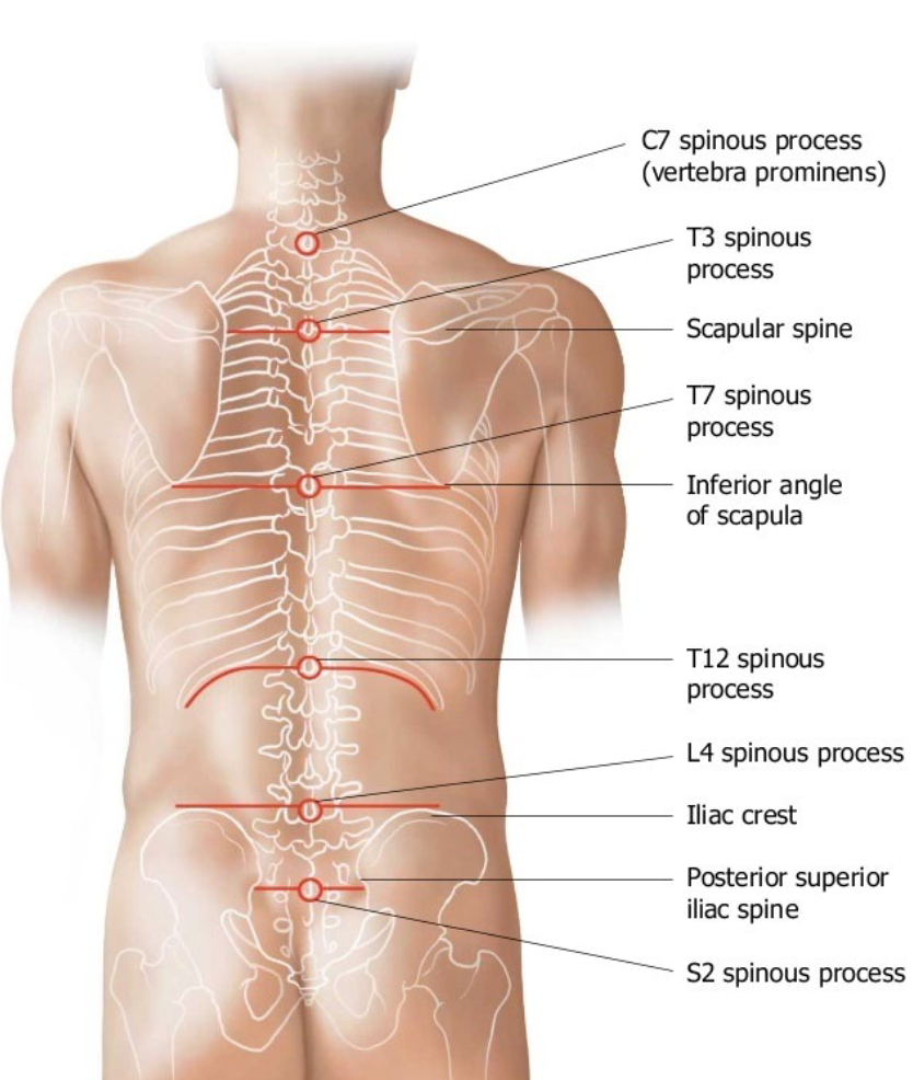 <ol><li><p>C7 vertebra prominens</p></li><li><p>T3 spine of scapula</p></li><li><p>T7 inferior angle of scapula</p></li><li><p>T12 12th rib</p></li><li><p>L4 highest point of iliac crest</p></li><li><p>S2 posterior superior iliac spine (PSIS).</p></li></ol><p>.</p><p>(1 - C, 3 - T, 1 - L, 1 - S)</p><p></p>