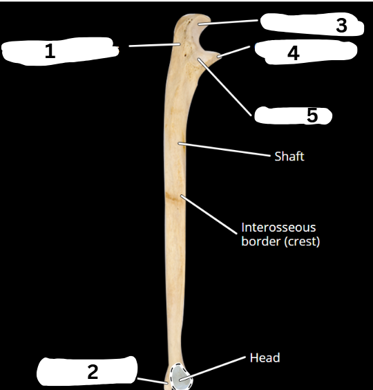 <p>What bone is this?</p>