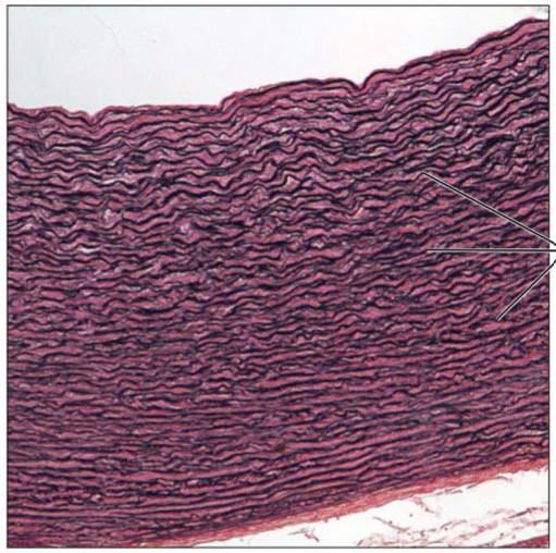 <p>Dense regular connective tissue containing a high proportion of elastic fibers. Allows tissue to recoil after stretching; maintains pulsatile flow of blood through arteries; aids passive recoil of lungs following inspiration. Walls of large arteries; within certain ligaments associated with the vertebral column; within the walls of the bronchial tubes.</p>