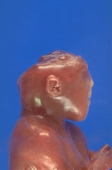 <p>defect in closure of the cephalic portion of the neural tube that results in incomplete development of the brain and bones of the skull</p>