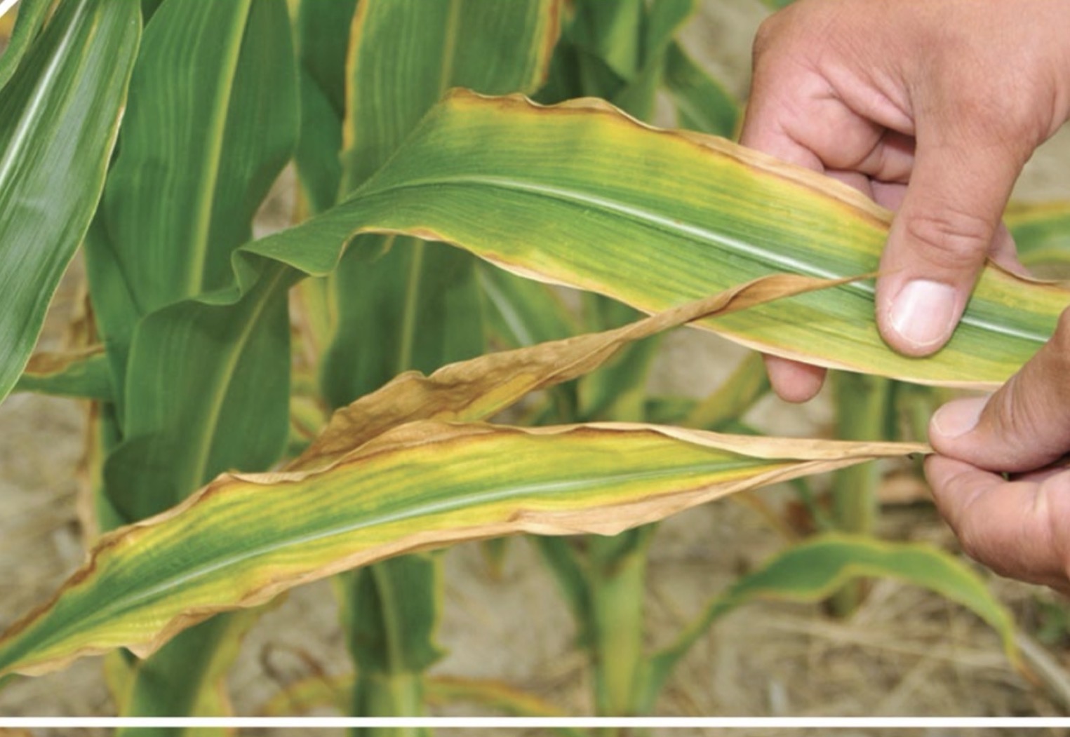 <p>Which deficiency is shown in the picture </p>