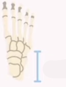 <p>name the bone and the bone shape:</p>