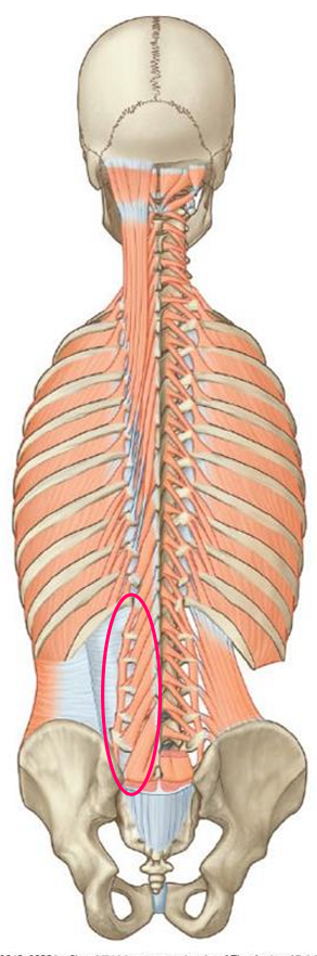 <p>Thicker transversospinalis muscles attached to the lumbar region of the vertebral column</p><ul><li><p>Allow for finer control of movement</p></li><li><p>Important in rehabilitation; improve smaller ‘segmental’ movements</p><ul><li><p>Injuries may arise if the multifidus is not supporting the spine at a local, controlled level</p></li></ul></li></ul><p></p>