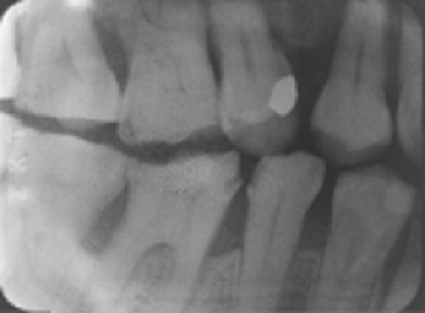 <p>What is the appearance of expired film?</p>