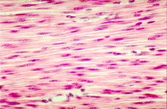 <p>A body tissue that contracts or shortens, making body parts move.</p>