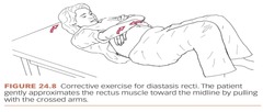<p>Separation of abdominal muscles, often postpartum.</p>