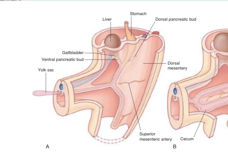 <p>Small Yolk sac</p>
