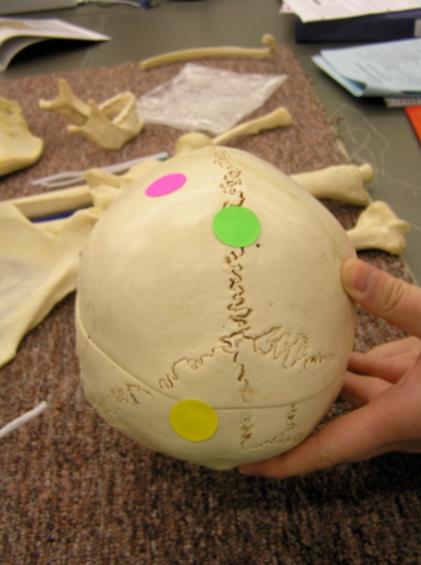 <p>Identify the bone labeled with the yellow dot. </p>