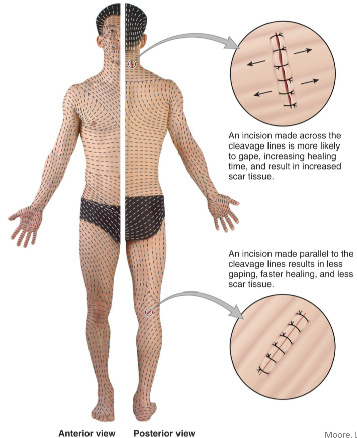 <p>Separations/less dense regions of collagen fibre bundles in the reticular dermis due to natural tension in the region</p>