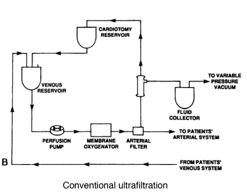 <p>Practice of withdrawing blood from the patient through venous reservoir during rewarming period and passing it through a hemoconcentrator and pumping it back into the patient through venous reservoir </p>