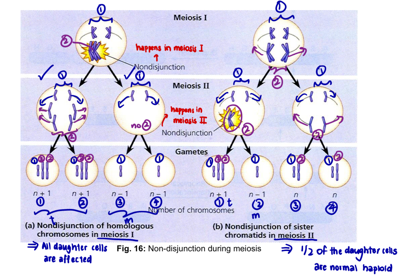 <ul><li><p><strong>Aneuploidy</strong>: general condition in which an organism<u> loses or gains one or more chromosomes</u>, but not a complete set</p></li><li><p>these chromosomal variations originate as a <u>random error</u> during the production of gametes</p></li><li><p><strong>non-disjunction</strong> is the <u>failure</u> of chromosomes or chromatids to <u>disjoin</u> and <u>move to opposite pole</u>s during division</p><ul><li><p>when this occurs in meiosis, the normal distribution of chromosomes into gametes is disrupted</p></li></ul></li><li><p>for the affected chromosome, abnormal gametes can be formed containing either two members or none at all</p></li><li><p>the <u>loss of a single chromosome</u> from an otherwise diploid genome —> <strong>monosomy</strong></p></li><li><p>gain of one chromosome —> <strong>trisomy</strong></p></li><li><p>fertilising these with a normal haploid gamete produces a <u>zygote</u> with either <u>three members</u> (trisomy) or only <u>one member </u>(monosomy) of this chromosome</p></li><li><p>non-disjunction leads to a variety of autosomal aneuploidy conditions in humans and other organisms</p></li></ul><p></p><p><u>Monosomy</u></p><ul><li><p>monosomy in humans <u>only occur for the X chromosome</u></p></li><li><p><strong>e.g. 45, X Turner syndrome </strong>- affected individuals have<u> only 45 chromosomes</u>, including just a single X chromosome</p></li><li><p>45, X (only 1 X copy present in the sex chromosome)</p><ul><li><p>these individuals generally have female external genitalia and internal ducts, but the ovaries are rudimentary (underdeveloped)</p></li><li><p>short stature, skin flaps on the back of the neck, underdeveloped breasts, broad shieldlike chest</p></li><li><p>intelligence normal</p></li></ul></li><li><p>monosomy for any of the autosomes is usually not tolerated in humans or other animals</p></li></ul><p><u>Trisomy</u></p><ul><li><p>e.g. <strong>47, XXY Klinefelter syndrome</strong> - affected individuals have more than one X chromosome</p></li><li><p>characteristics</p><ul><li><p>genitalia and internal ducts that are usually male</p></li><li><p>but their testes are rudimentary and fail to produce sperm</p></li><li><p>generally tall and have long arms and legs and large hands and feet</p></li><li><p>although masculine developed does occur, feminine sexual development is not entirely suppressed</p></li><li><p>slight enlargement of breasts is common, hips are often rounded</p></li></ul></li><li><p>intersexuality, which may lead to abnormal social development</p></li><li><p>intelligence often below the normal range</p></li><li><p>e.g. <strong>Down syndrome</strong> - the only human autosomal trisomy in which a significant number of individuals survive longer than a year past birth</p><ul><li><p>affected individuals have an extra chromosome 21</p></li><li><p>characteristics</p><ul><li><p>short</p></li><li><p>skin folds over the corner of their eyes</p></li><li><p>stocky bodies</p></li><li><p>thick necks</p></li><li><p>prone to heart abnormalities</p></li><li><p>short life expectancy</p></li><li><p>low intelligence level</p></li></ul></li></ul></li></ul><p></p>