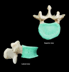 <p>Category: Typical Vertebra</p>