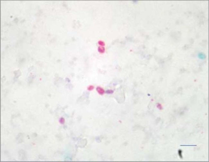 <p><span>1&nbsp;<strong>µm </strong>Chromotrope Stain</span></p>