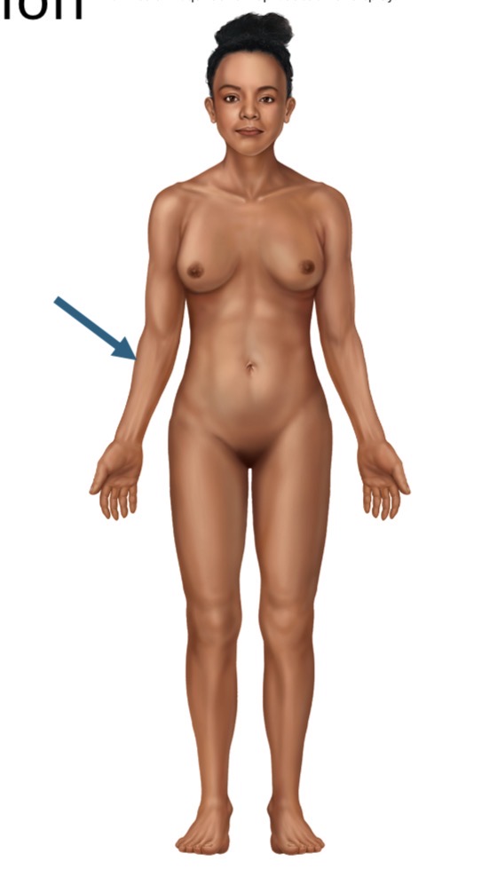 <p>Name the body part or region</p>
