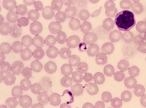 <p><span style="background-color: rgba(0, 0, 0, 0); line-height: 19.7625px;">What is the species in this photo? what disease is it associated with?</span></p>