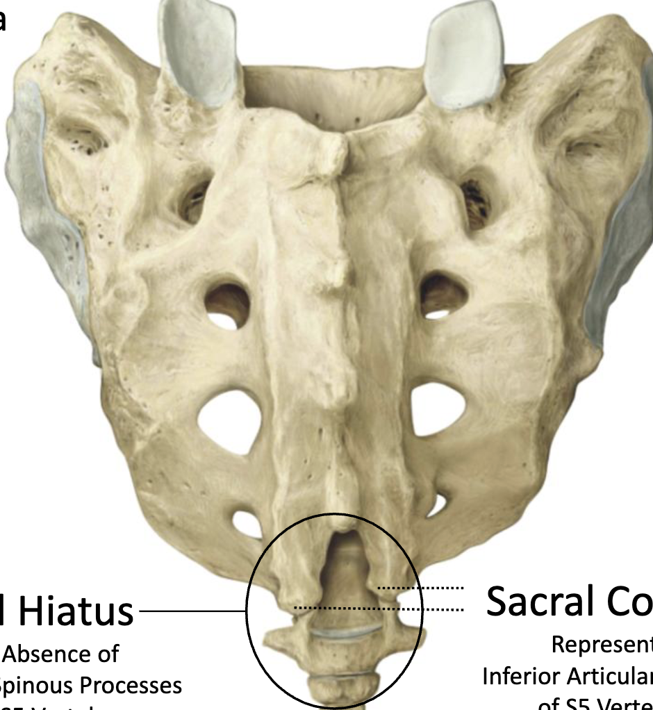 <p>What do the Sacral Cornua represent</p>